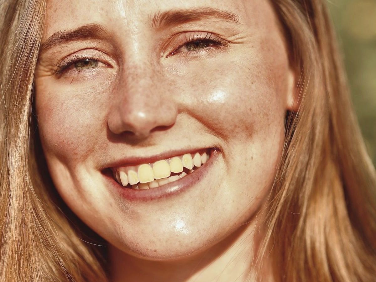 Lächeln mit leicht gelblich verfärbten Schneidezähnen vor dem Bleaching